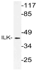 AP21113PU-N - Integrin-linked protein kinase