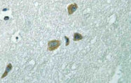AP21113PU-N - Integrin-linked protein kinase