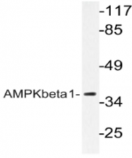 AP20964PU-N - AMPK beta-1 chain / AMPKb