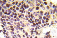 AP20969PU-N - BRCA1 / RNF53