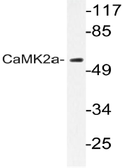 AP20970PU-N - CAMK2A