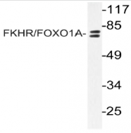 AP20978PU-N - FOXO1A