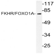 AP20979PU-N - FOXO1A