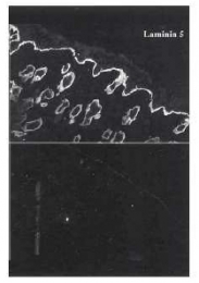 AP02111PU-S - Laminin beta 3 / Laminin-5