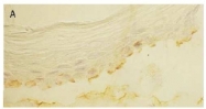 AM02112PU-S - Laminin beta 3 / Laminin-5