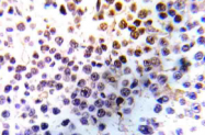 AP20983PU-N - Histone H3.1