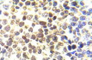 AP20984PU-N - Histone H3.1