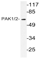 AP20990PU-N - PAK1/PAK2