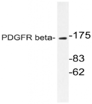 AP20991PU-N - CD140b / PDGFRB