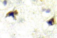 AP20991PU-N - CD140b / PDGFRB