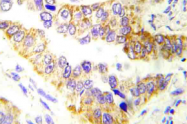 AP21005PU-N - Tuberin / TSC2