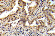 AP21006PU-N - Tuberin / TSC2