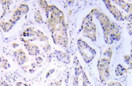 AP21009PU-N - EIF4EBP1 / 4E-BP1