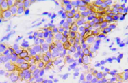 AP21011PU-N - CD246 / Anaplastic lymphoma kinase