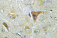 AP21013PU-N - Amyloid beta A4 protein / APP