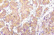 AP21016PU-N - Catenin beta-1