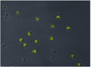AM03029FC-N - TER ATPase / VCP