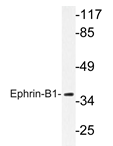 AP20226PU-N - Ephrin-B1