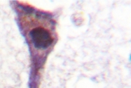 AP06544PU-N - PPP1R12A / MYPT1