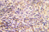 AP21021PU-N - Cofilin-1