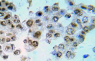 AP21024PU-N - DNA-PKcs / PRKDC / XRCC7