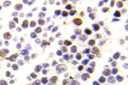 AP20892PU-N - Histone H3.1