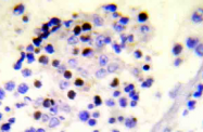 AP20894PU-N - Histone H2A.x