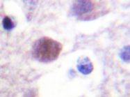 AP20223PU-N - DNA-PKcs / PRKDC / XRCC7