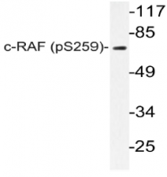 AP20904PU-N - RAF1