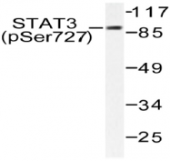 AP20907PU-N - STAT3