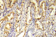 AP20914PU-N - Tuberin / TSC2