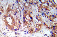 AP20915PU-N - Tuberin / TSC2