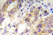AP20916PU-N - Tuberin / TSC2