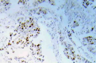 AP20917PU-N - EIF4EBP1 / 4E-BP1
