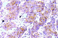 AP20921PU-N - CD246 / Anaplastic lymphoma kinase