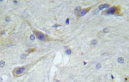 AP20923PU-N - Amyloid beta A4 protein / APP