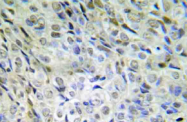 AP20926PU-N - Catenin beta-1