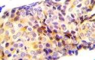 AP20927PU-N - Catenin beta-1