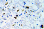 AP20928PU-N - CDK1