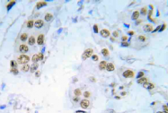 AP20936PU-N - DNA-PKcs / PRKDC / XRCC7