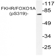 AP20888PU-N - FOXO1A
