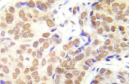AP20947PU-N - HDAC1