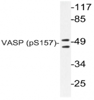 AP20814PU-N - VASP