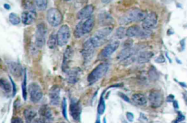 AP20826PU-N - Catenin beta-1