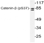 AP20827PU-N - Catenin beta-1