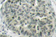 AP20827PU-N - Catenin beta-1