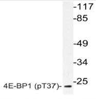 AP20834PU-N - EIF4EBP1 / 4E-BP1