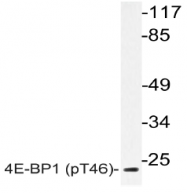 AP20835PU-N - EIF4EBP1 / 4E-BP1