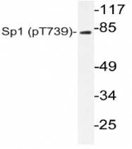 AP20842PU-N - SP1 / TSFP1