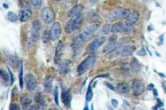 AP20826PU-N - Catenin beta-1